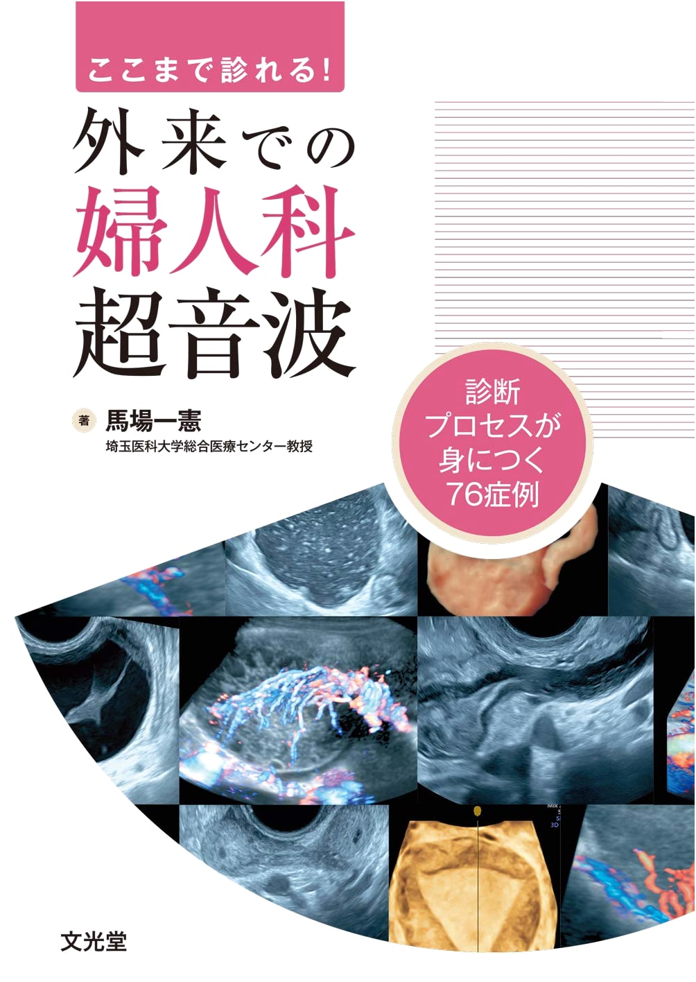 Gynecological Ultrasound in Outpatient Settings: A Practical Guide by Kazunori Baba