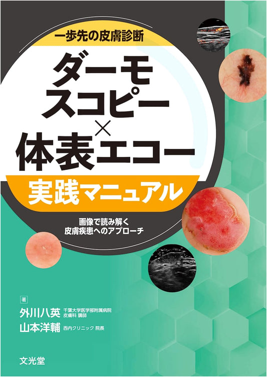 Advanced Skin Diagnosis: Dermoscopy & Ultrasound Practical Manual – Image-Based Approach