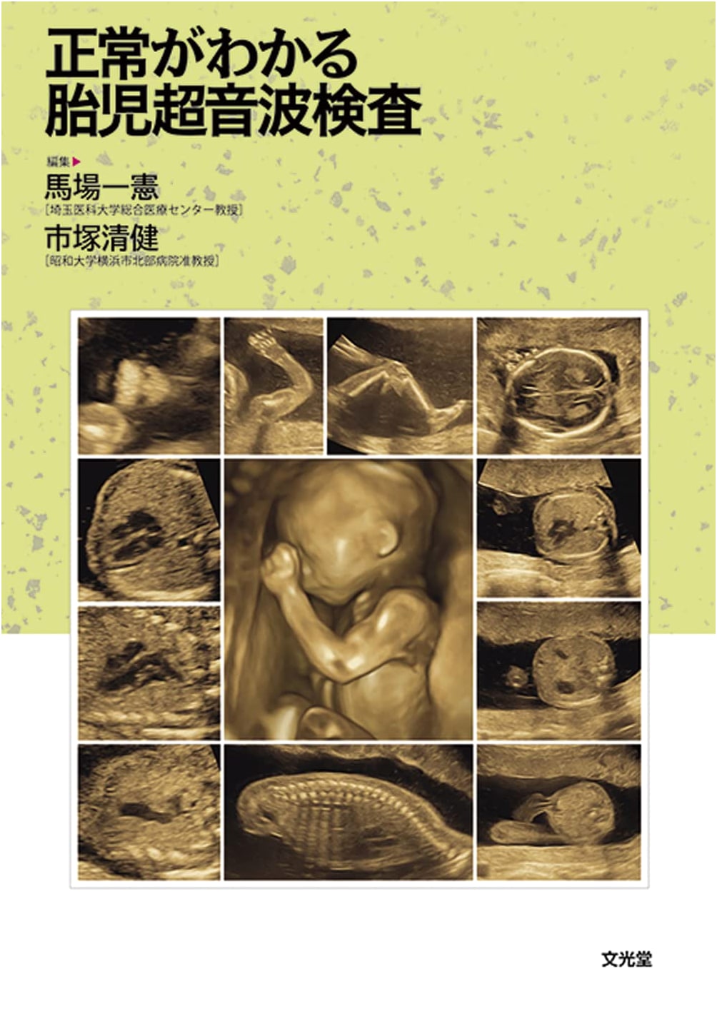 Understanding Normal Fetal Ultrasound