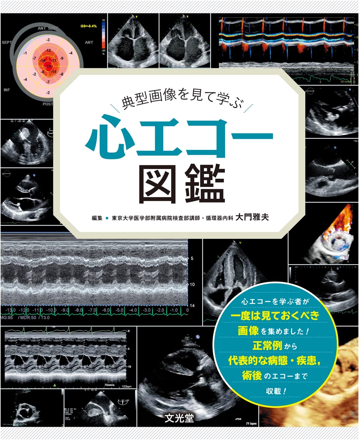 Cardiac Echocardiography Atlas: A Visual Guide to Typical Images
