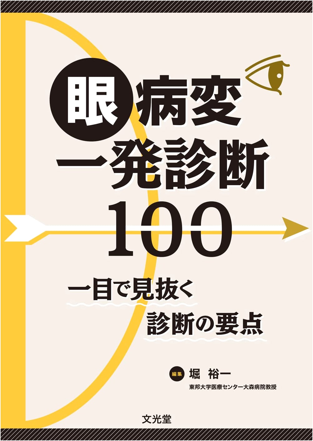 Instant Diagnosis of 100 Eye Conditions: Key Diagnostic Points at a Glance