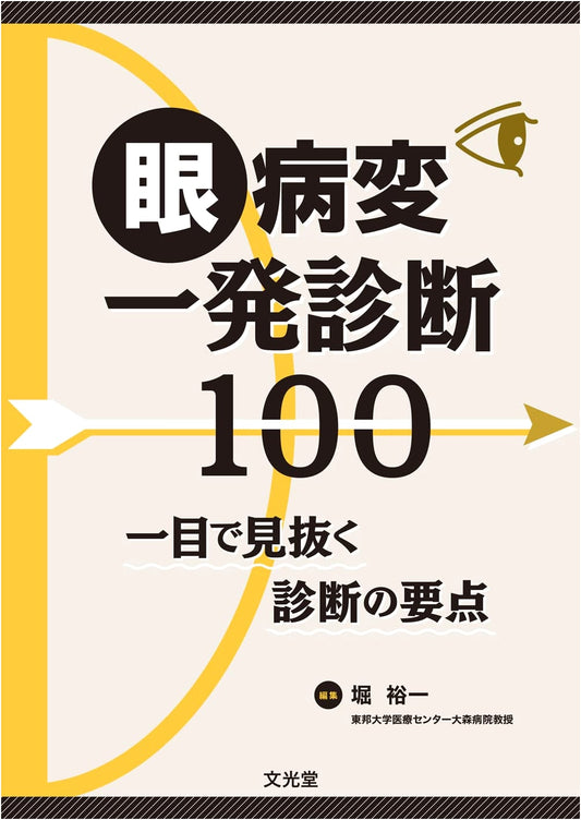Instant Diagnosis of 100 Eye Conditions: Key Diagnostic Points at a Glance