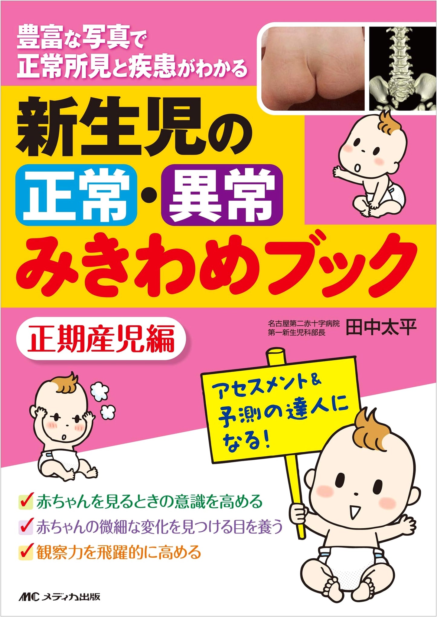 Newborn Assessment Book: Identifying Normal and Abnormal in Full-Term Infants