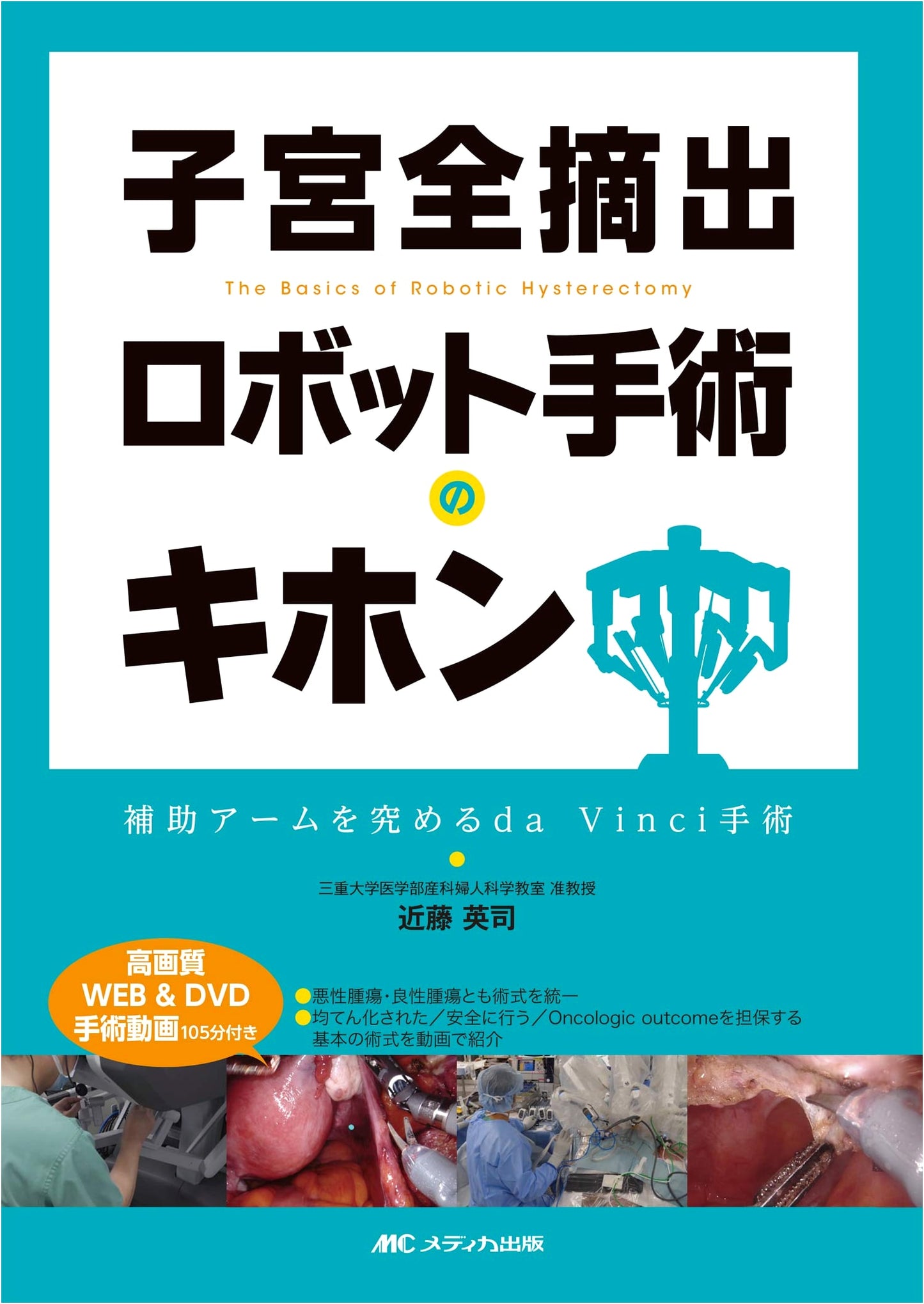 Total Hysterectomy: Robot-Assisted da Vinci Surgery by Eiji Kondo