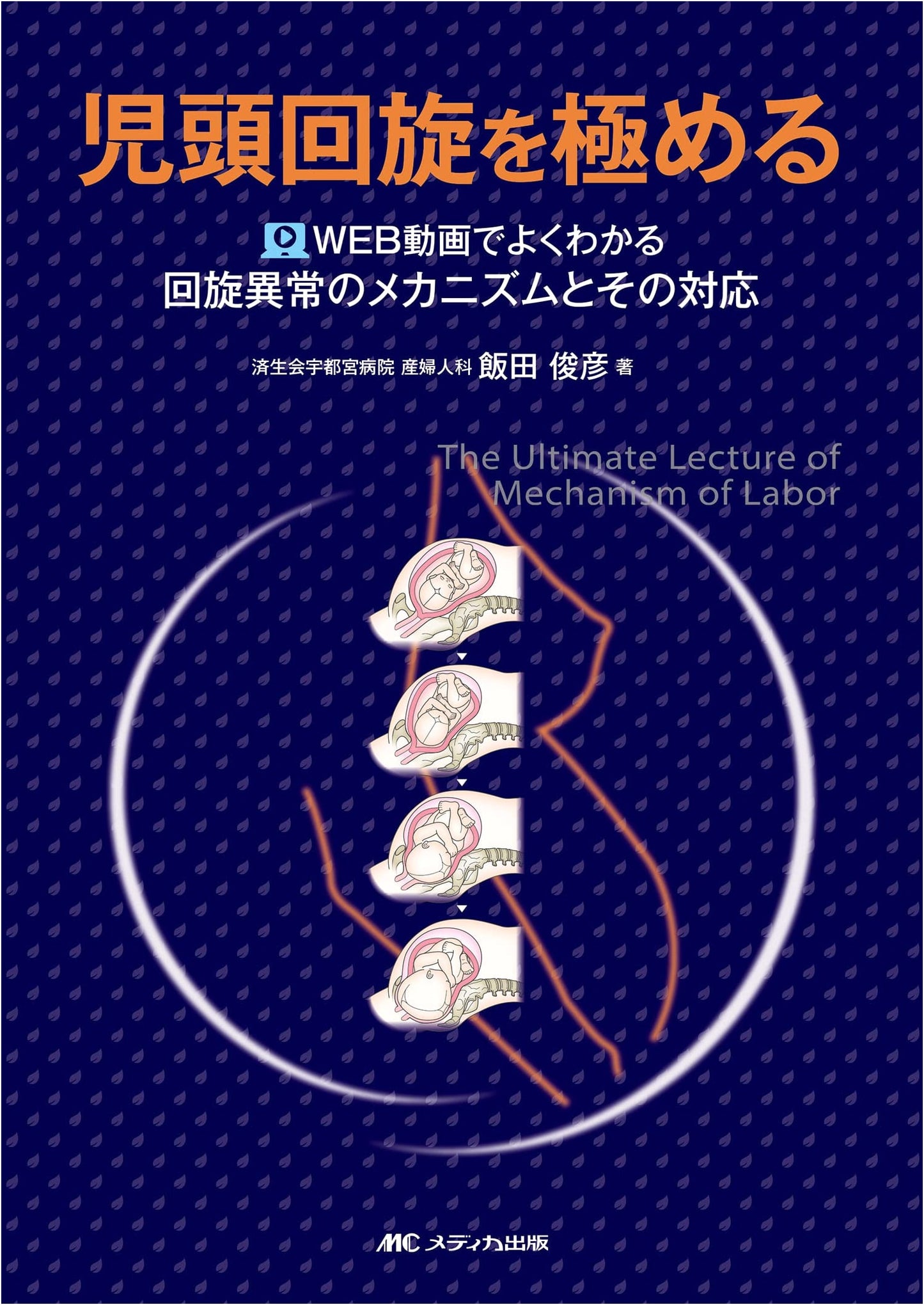 Mastering Fetal Head Rotation: Mechanisms & Management of Abnormal Rotation with Web Videos