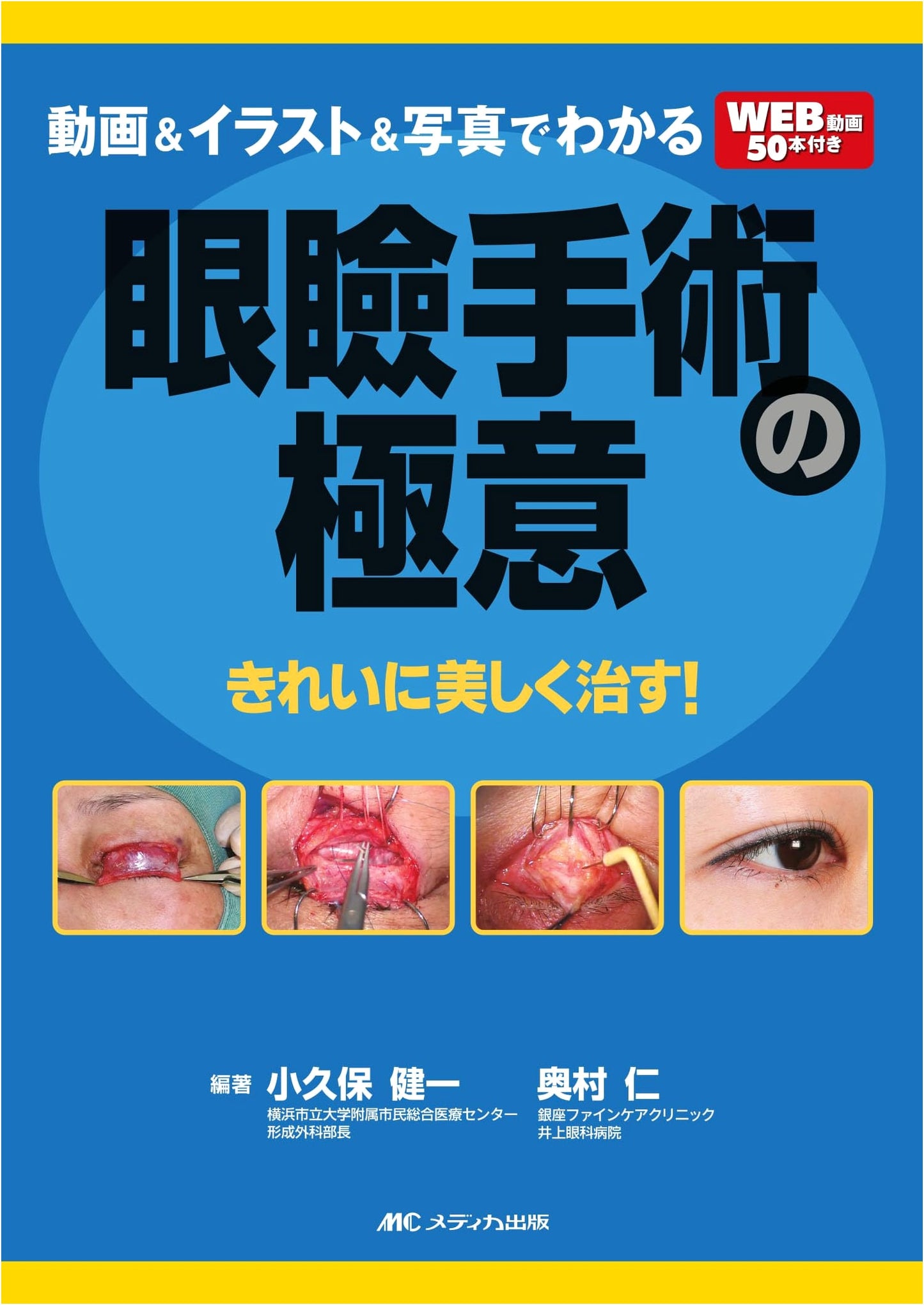 Eyelid Surgery Secrets: A Visual Guide to Beautiful Healing with Videos, Illus. & Photos