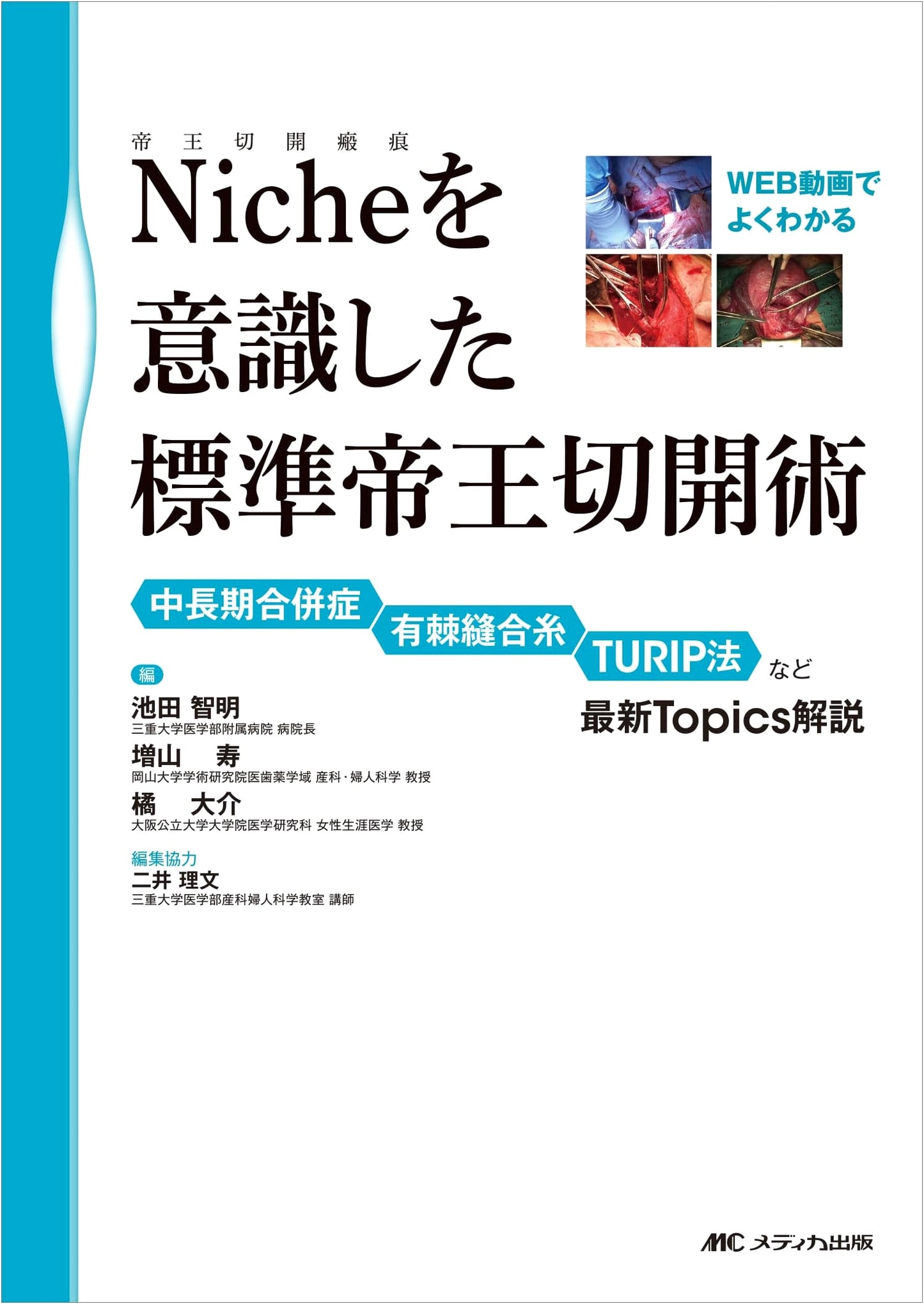 Standard Cesarean Section with Focus on the Niche: A Video Guide