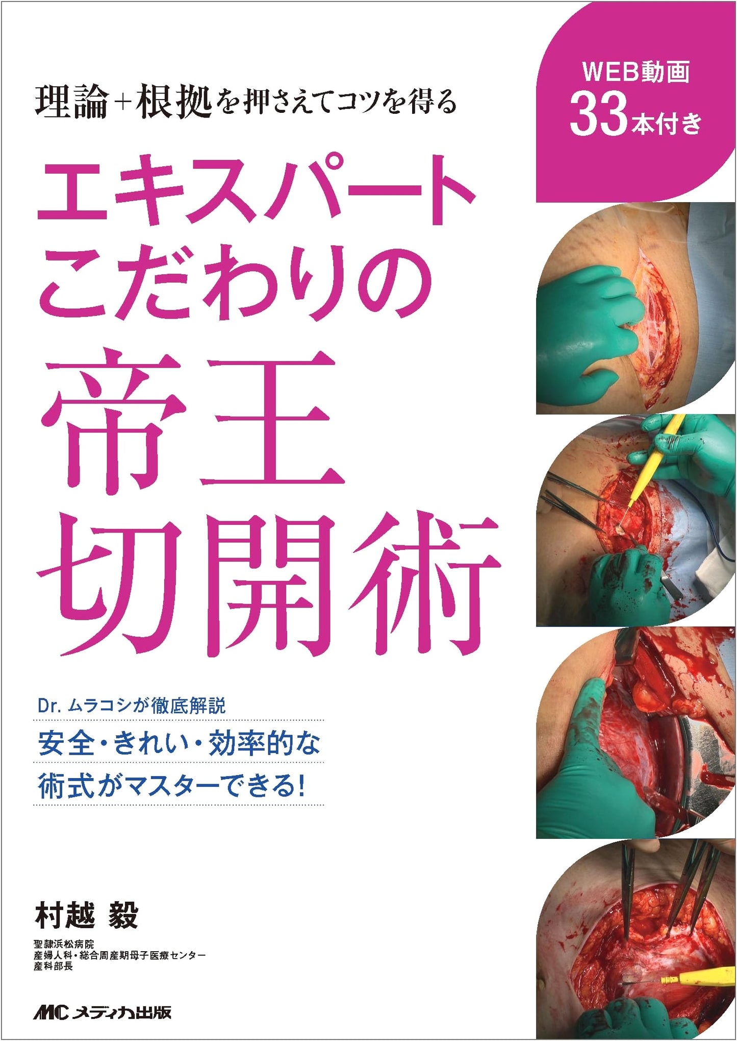 Expert Techniques in Cesarean Section: Theory, Evidence, and Practical Tips by Takeshi Murakoshi