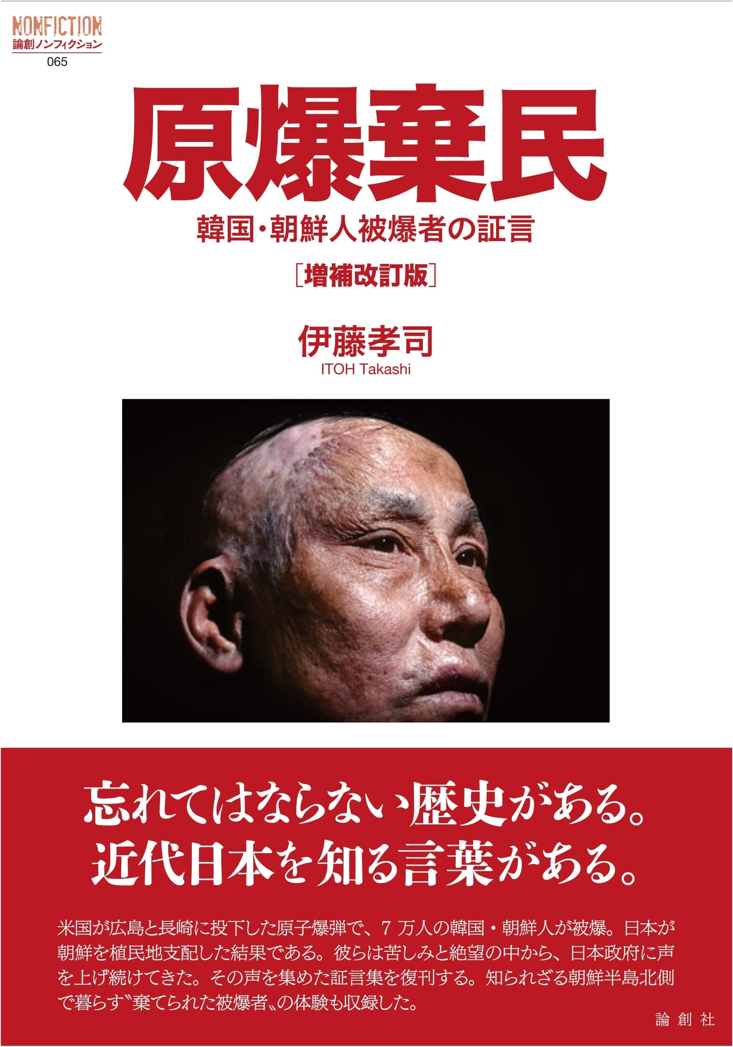 Atomic Bomb A-Bomb Survivors: Testimonies of Korean Survivors, by Koji Ito