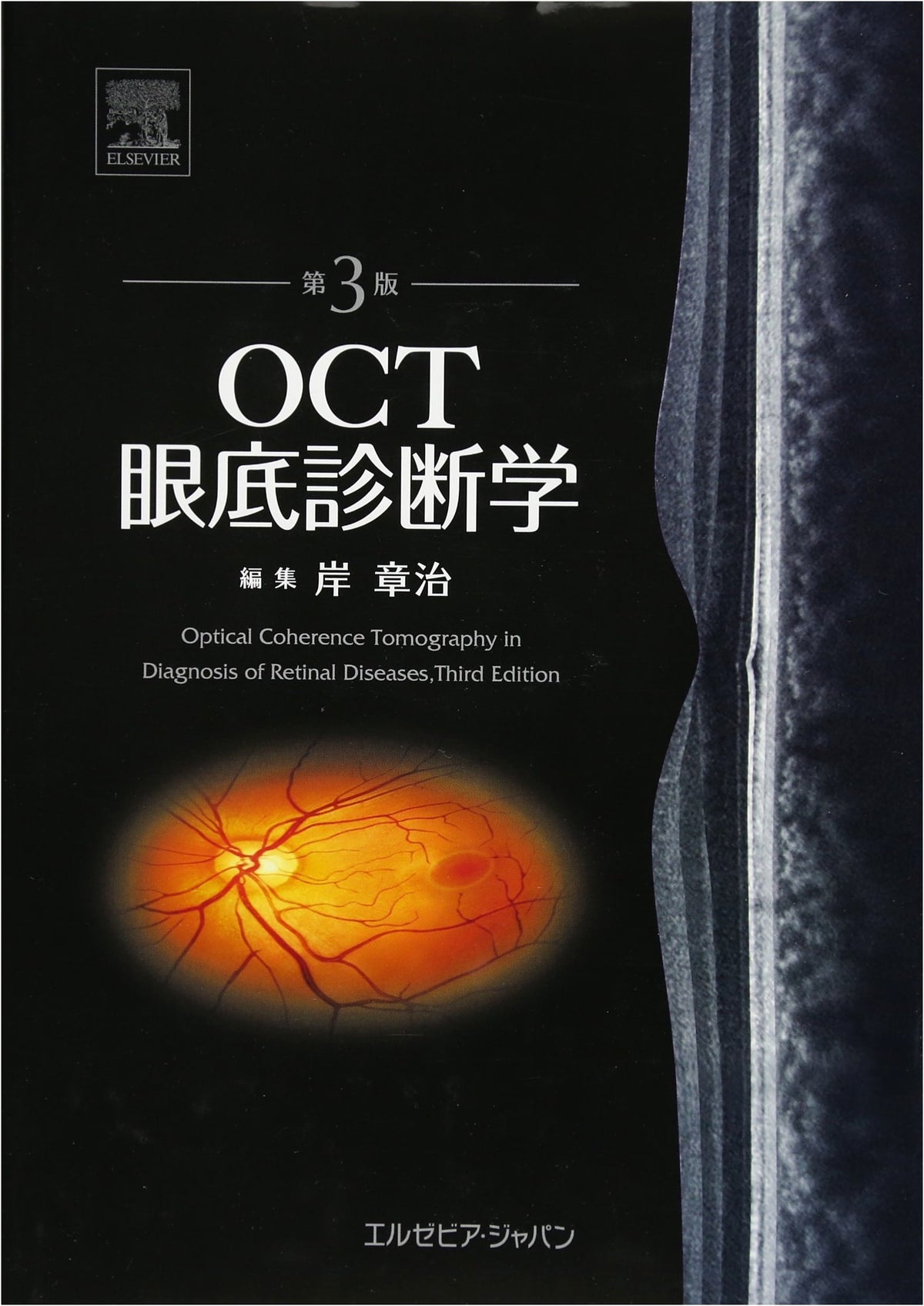 OCT Fundus Diagnosis 3rd Edition
