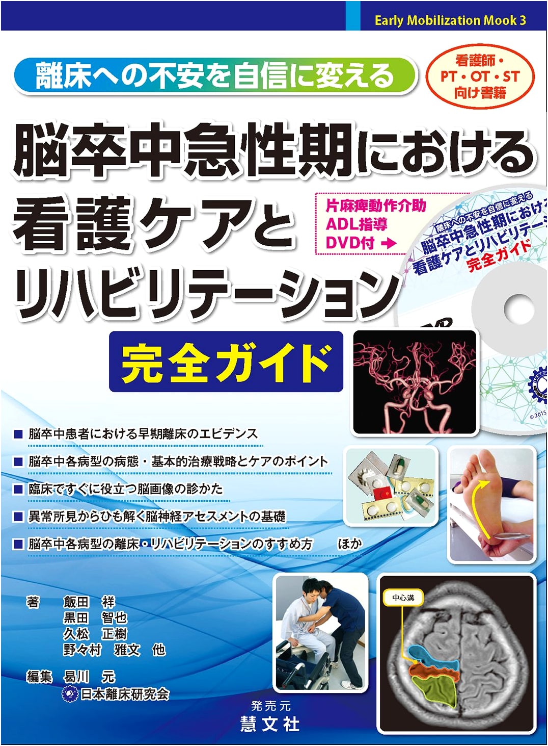 Stroke Acute Phase Nursing Care & Rehabilitation: From Anxiety to Confidence in Early Mobilization