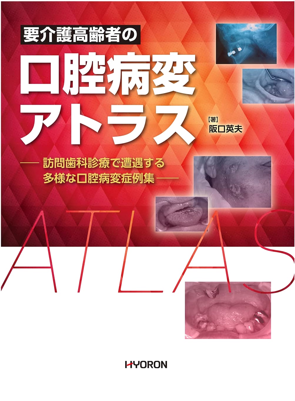 Oral Lesion Atlas for Elderly Requiring Nursing Care