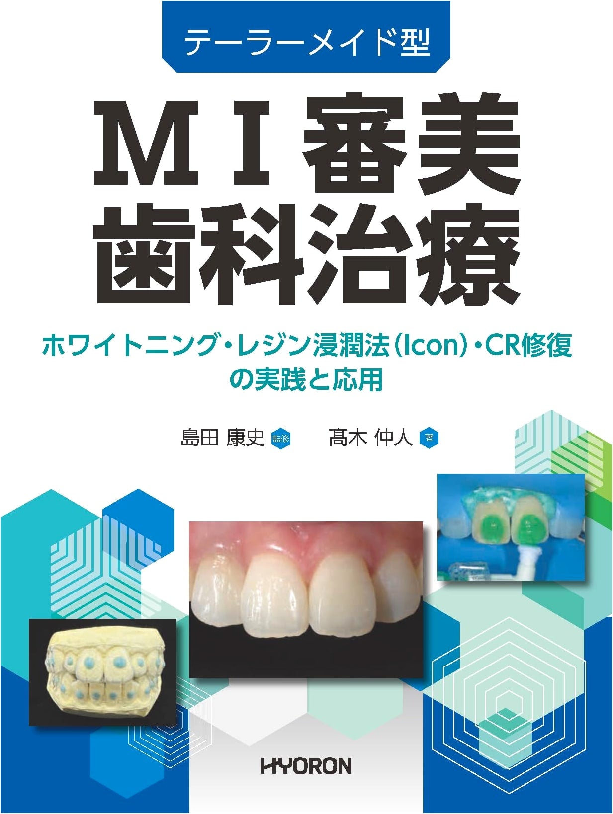 Tailor-Made MI Aesthetic Dentistry: Whitening, Resin Infiltration (Icon), and CR Restoration