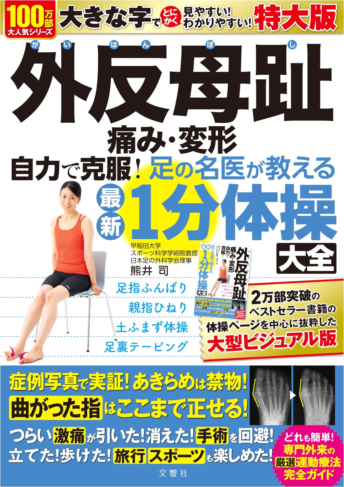 Bunkyosha: Overcoming Bunions: Pain & Deformity – Self-Help 1-Minute Exercises