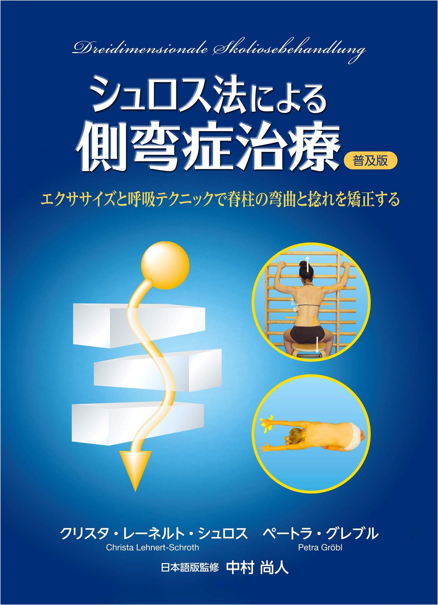 Schroth Method for Scoliosis Treatment (Popular Edition): Correcting Spinal Curvature