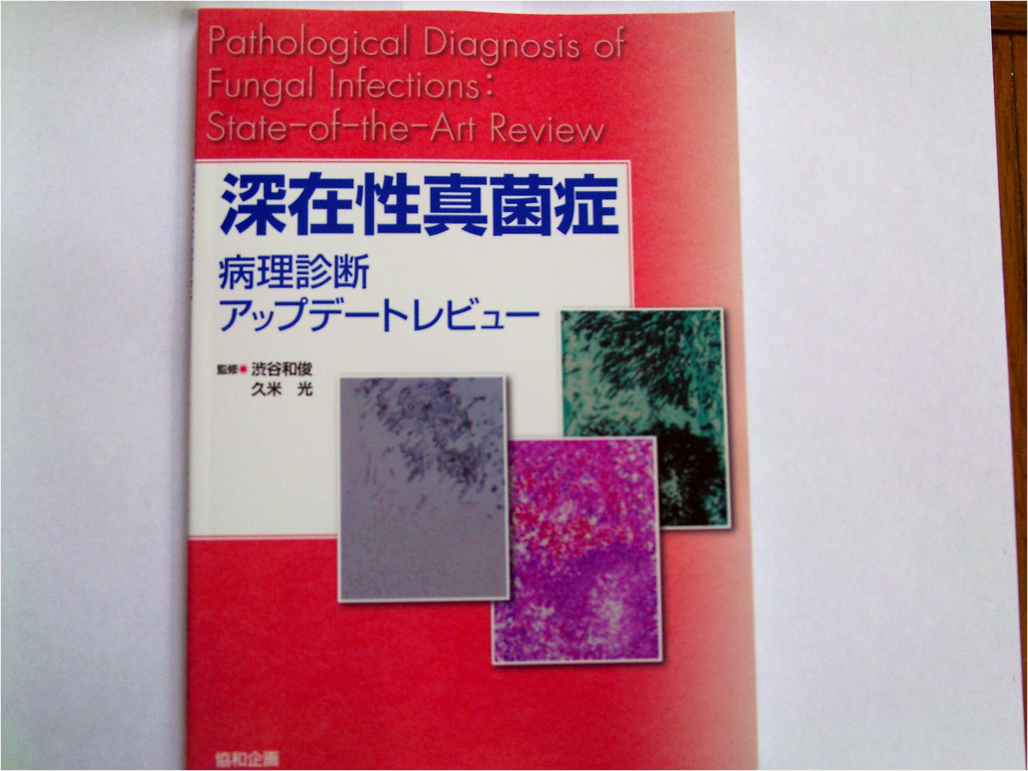 Deep-Seated Mycosis: Updates in Pathological Diagnosis Review