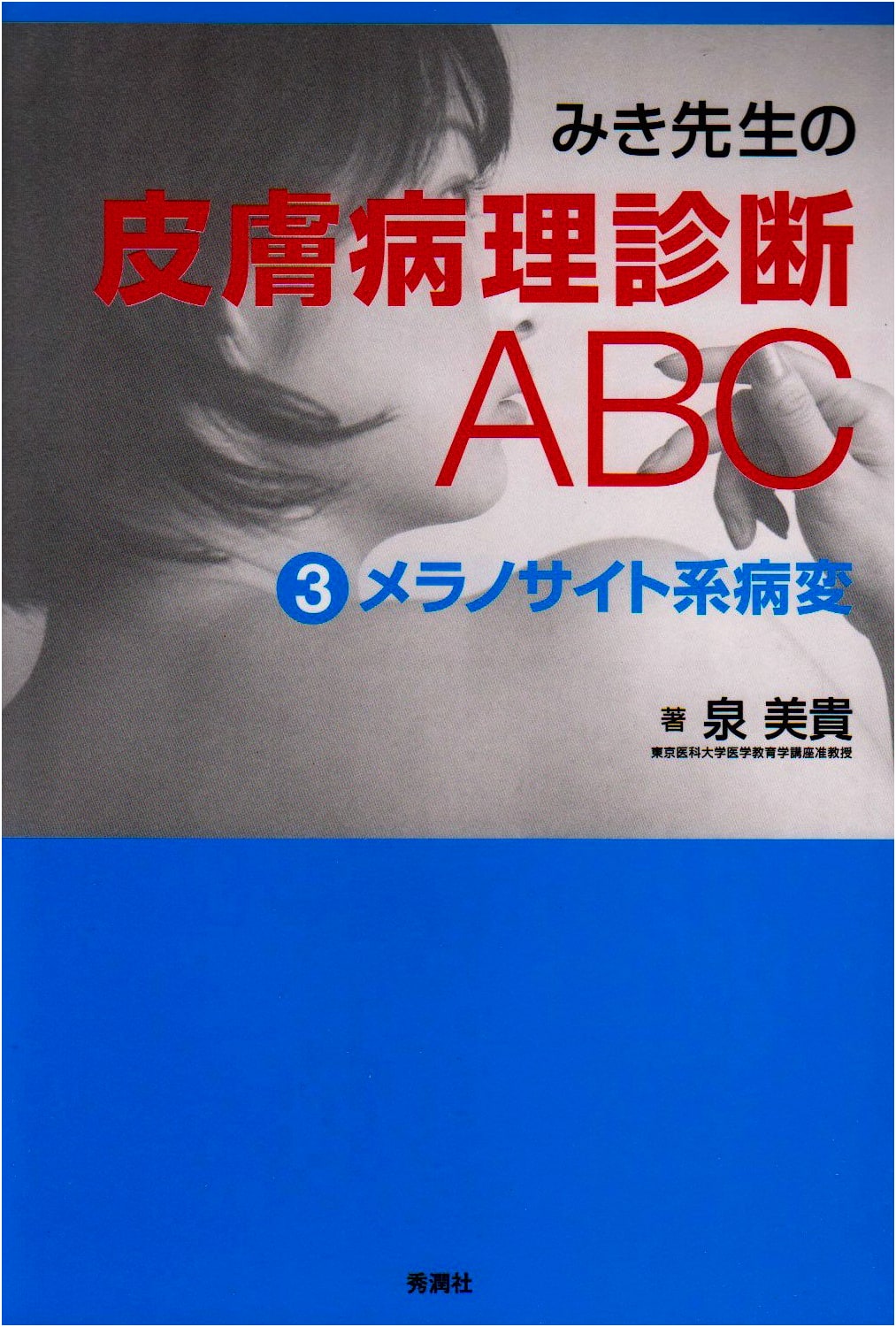 Dr. Miki's ABCs of Dermatopathology Diagnosis 3: Melanocytic Lesions