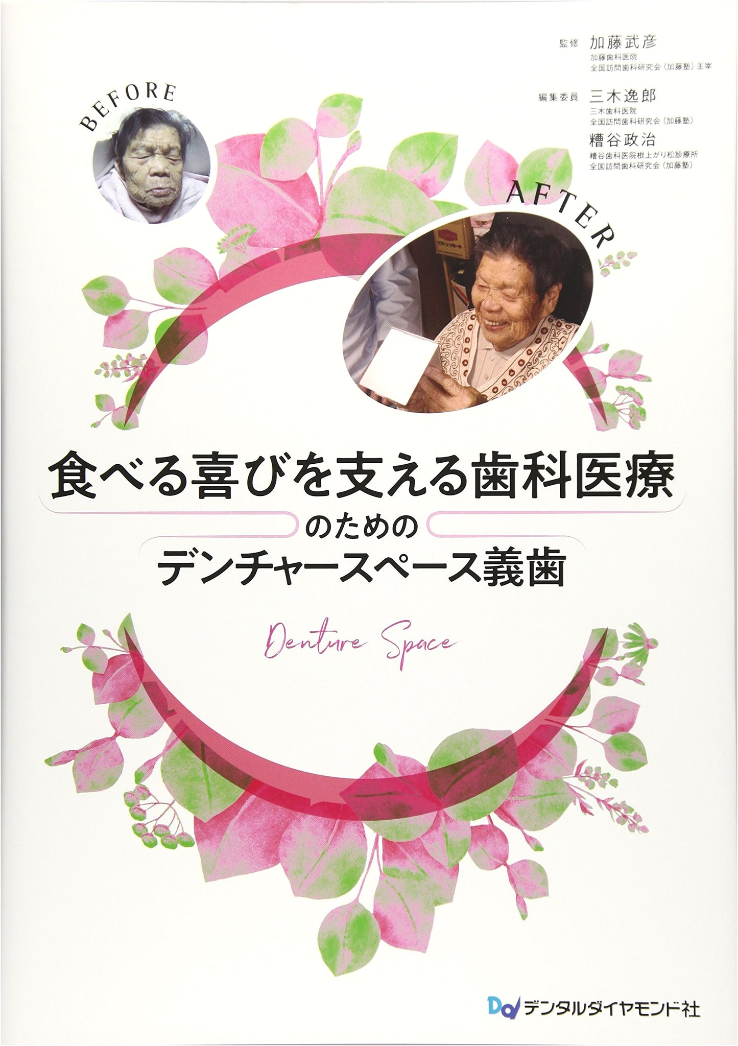 Denturespace Dentures for Dental Care Supporting the Joy of Eating