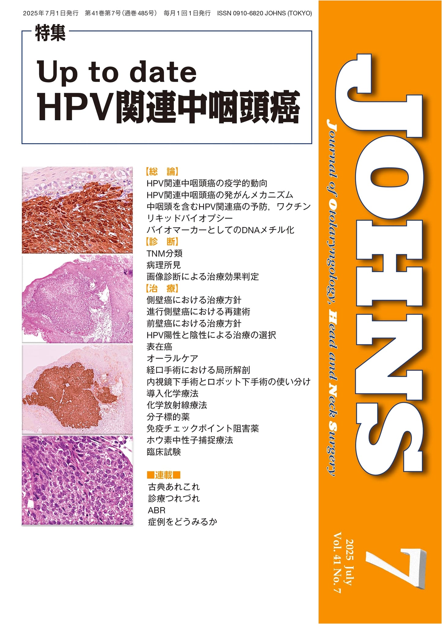 JOHNS Vol. 41 No. 7, July 2025: Up-to-Date HPV-Related Oropharyngeal Cancer