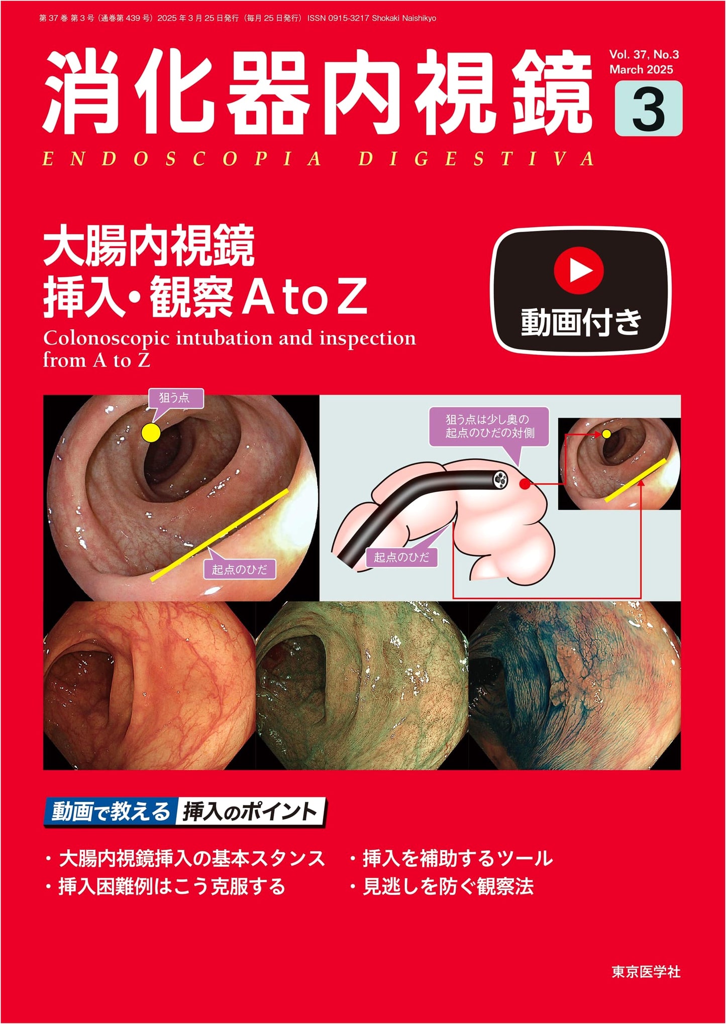 Gastrointestinal Endoscopy Vol. 37 No. 3, March 2025: Colonoscopy Insertion & Observation A to Z