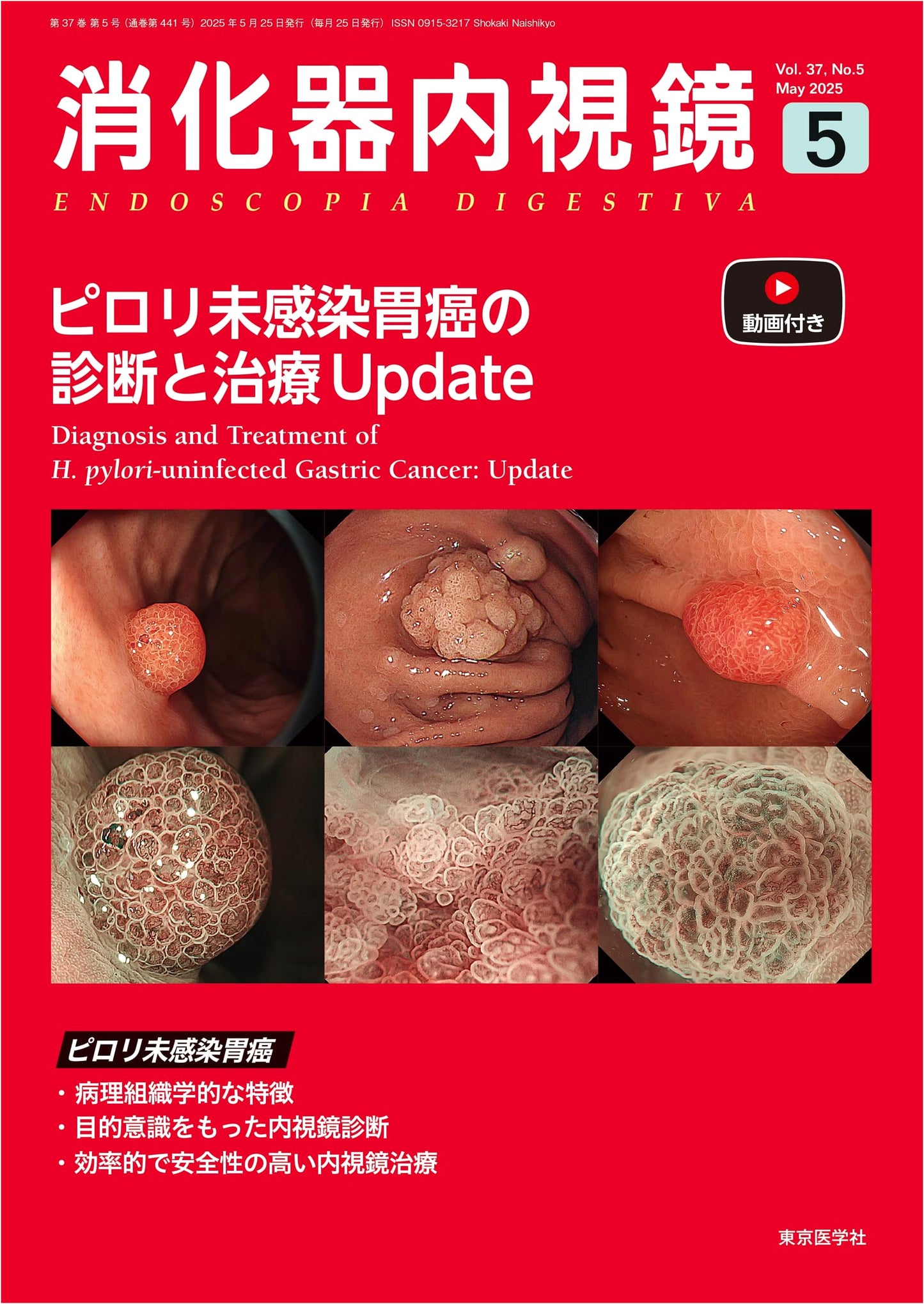 Gastrointestinal Endoscopy Vol. 37 No. 5, May 2025: Diagnosis & Treatment Update for H. Pylori-Negative Gastric Cancer