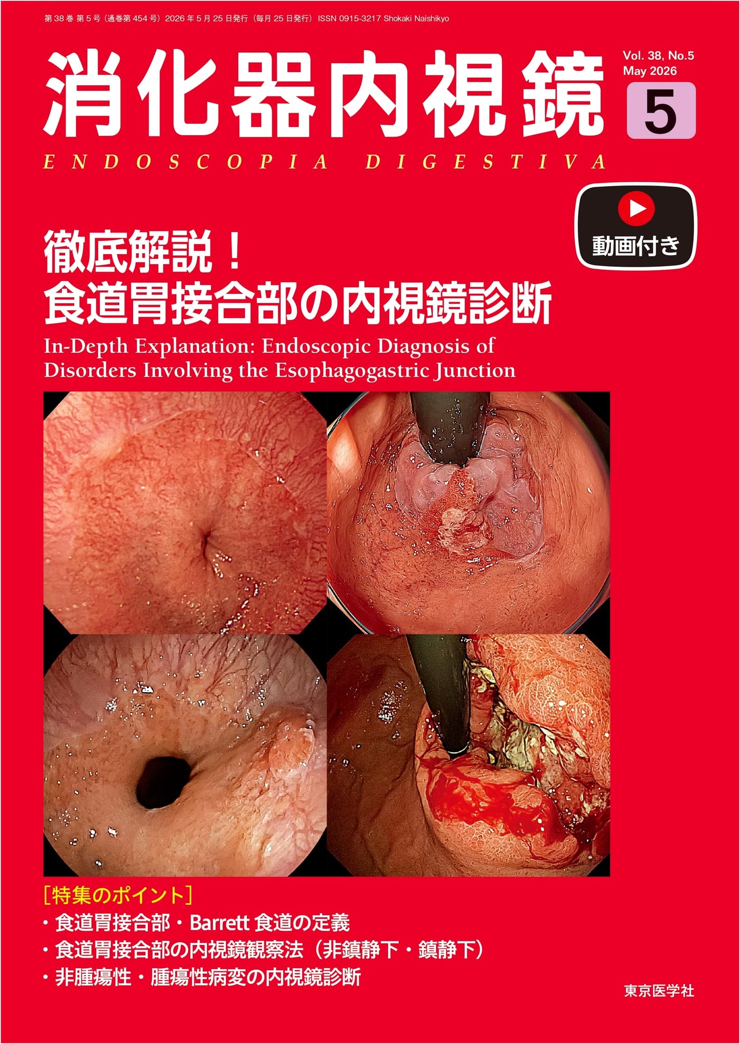 Digestive Endoscopy Vol. 38, No. 5 (May 2026): Comprehensive Guide to Endoscopic Diagnosis of the Esophago-Gastric Junction