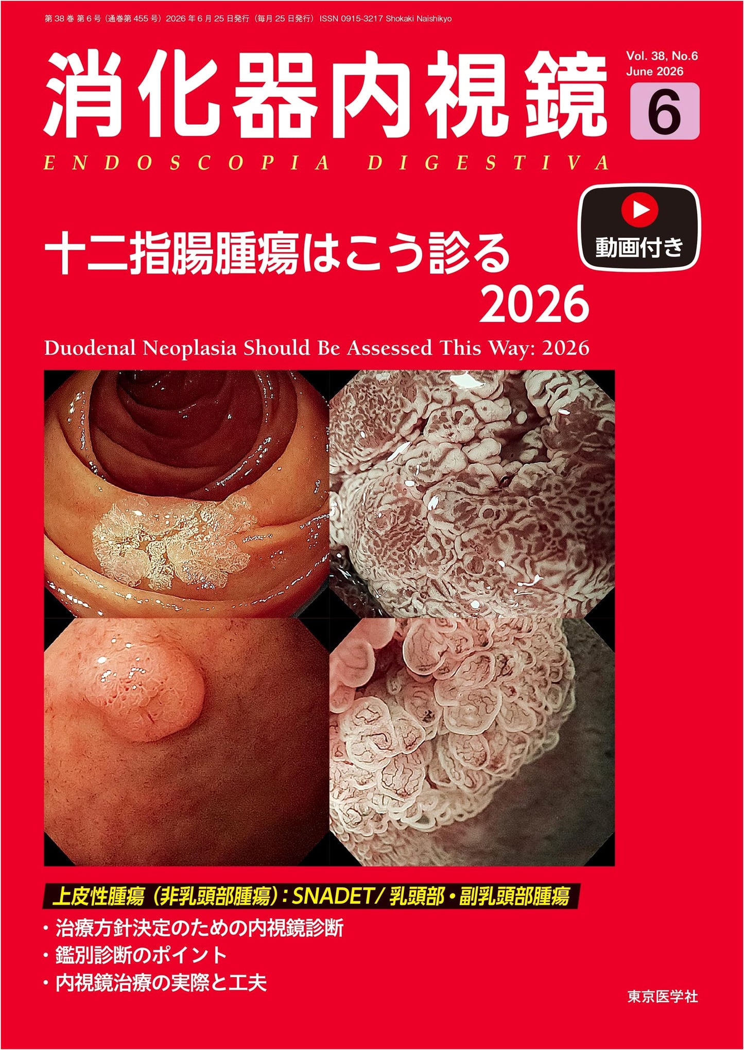 Gastrointestinal Endoscopy: How to Diagnose Duodenal Tumors 2026 (June 2026, Vol. 38 No. 6)