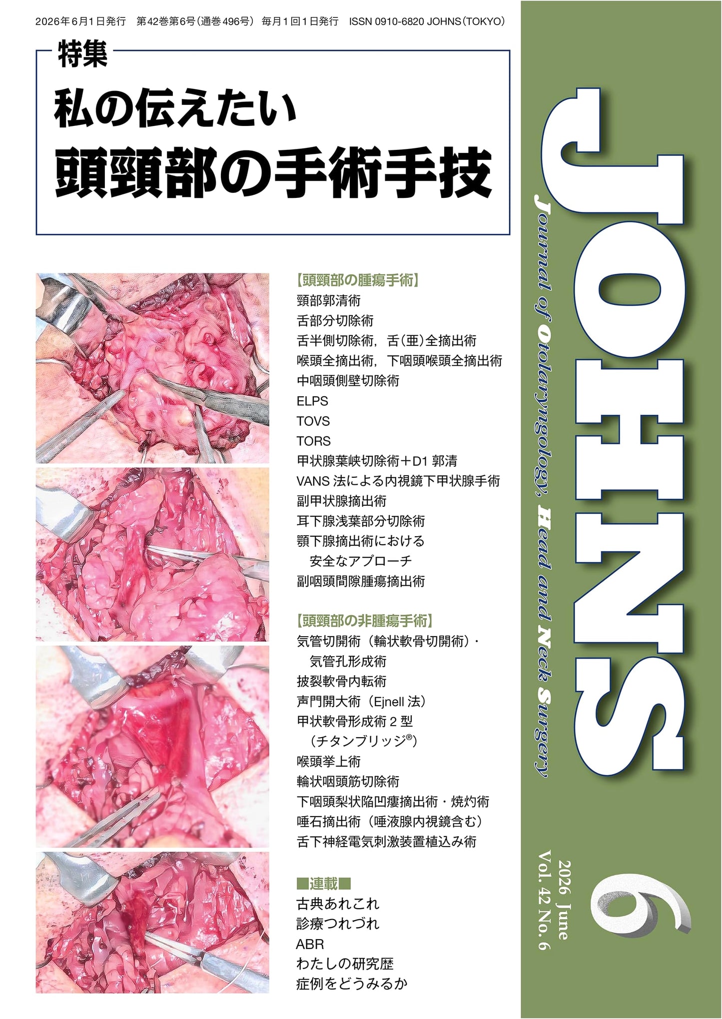 JOHNS Vol. 42 No. 6, June 2026: My Head and Neck Surgical Techniques