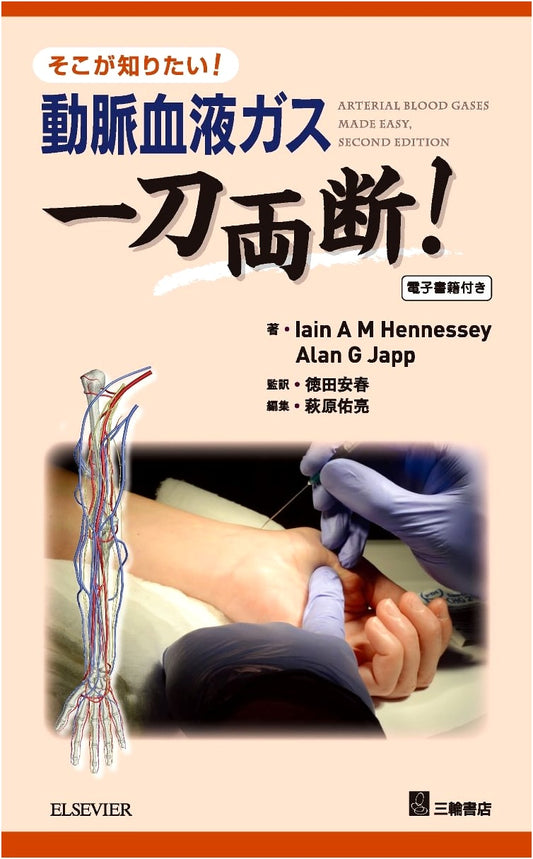 Arterial Blood Gas: Clear-Cut Answers to What You Need to Know! (The Decisive Series)
