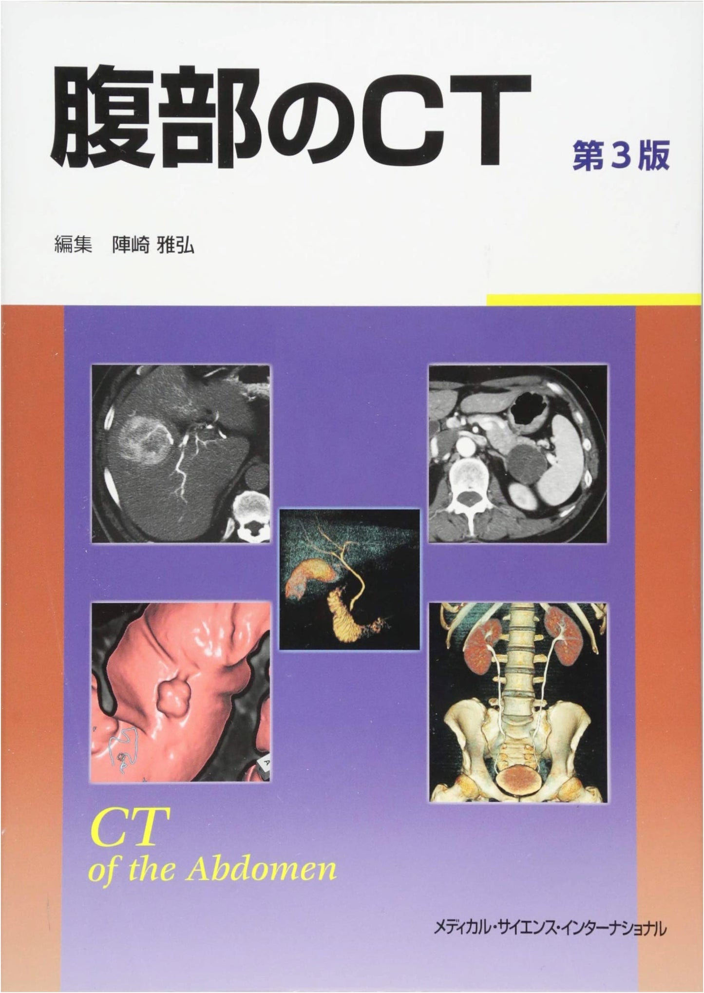 Abdominal CT Scan: 3rd Edition