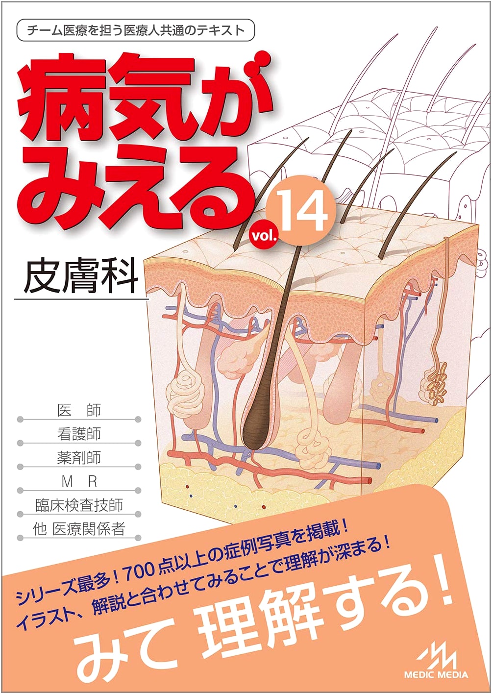 Visible Diseases Vol. 14: Dermatology (1st Edition)