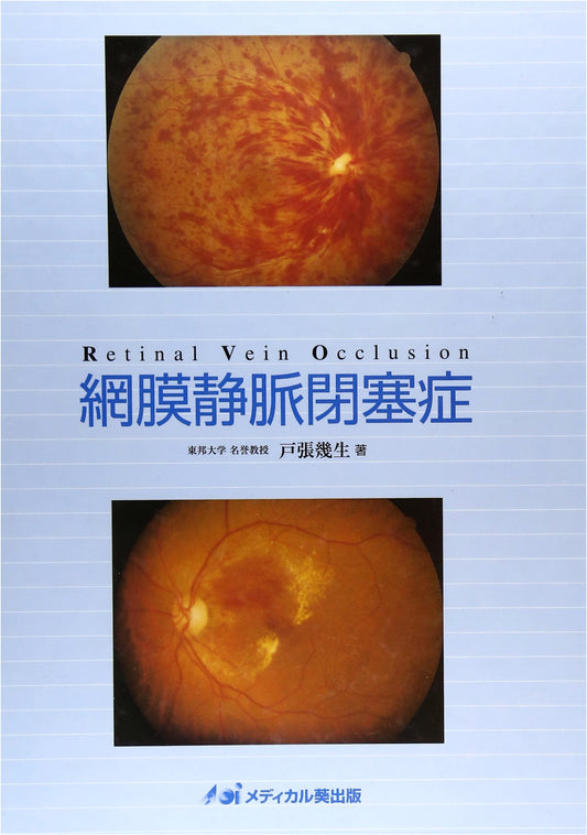 Retinal Vein Occlusion