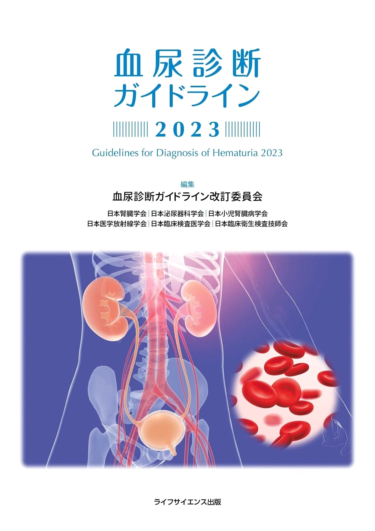 Hematuria Diagnosis Guidelines 2023