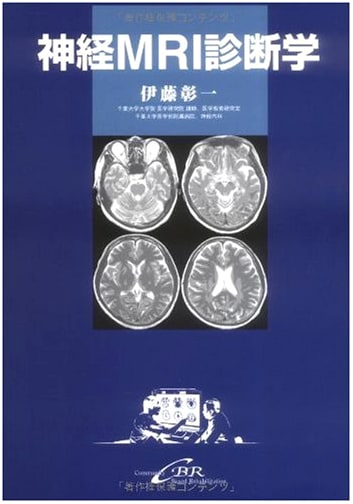 Neurological MRI Diagnostics