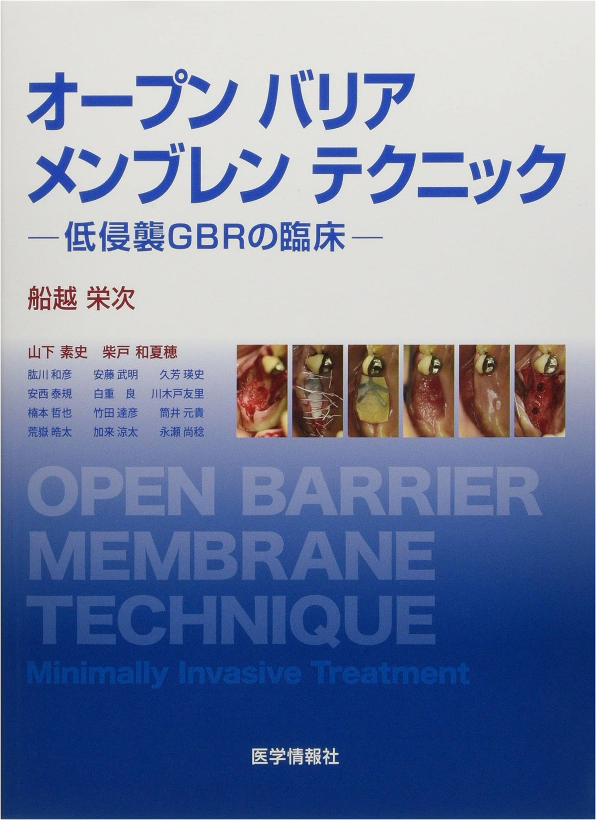 Open Barrier Membrane Technique: Clinical Low-Invasive GBR