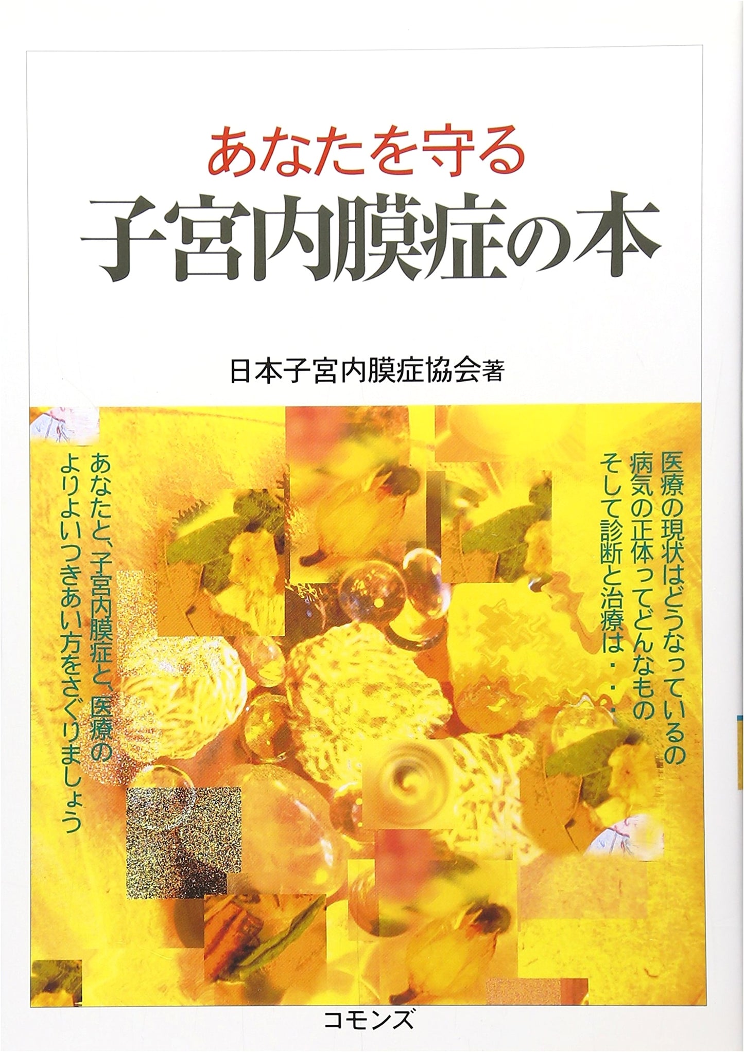 Protect Yourself: A Guide to Understanding Endometriosis by the Japan Endometriosis Association
