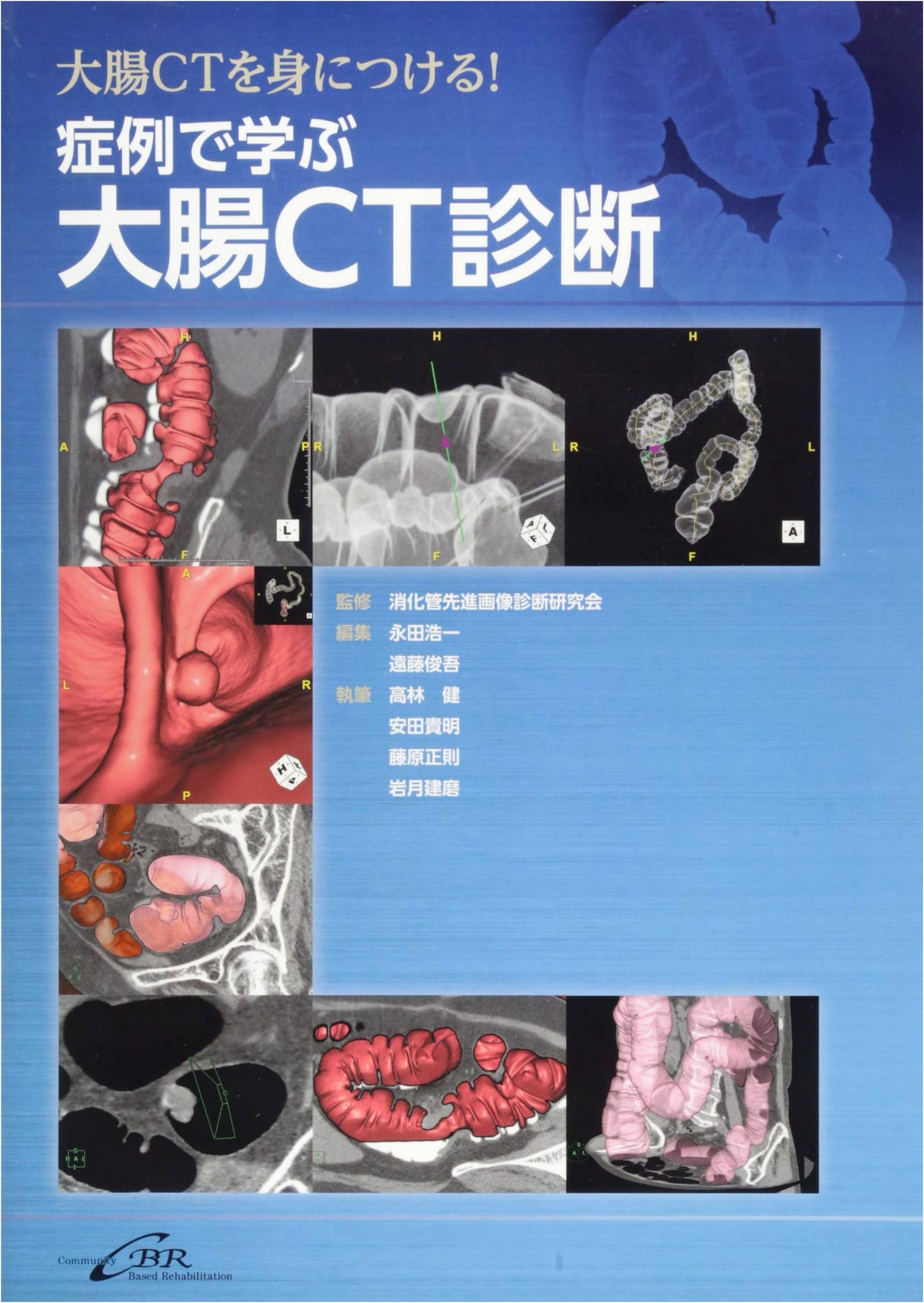 Colorectal CT Diagnosis: A Case Study Approach