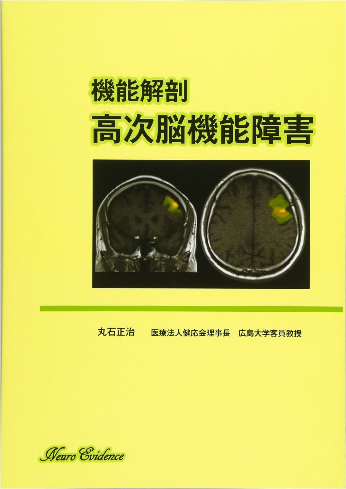 Functional Anatomy and Higher Brain Dysfunction