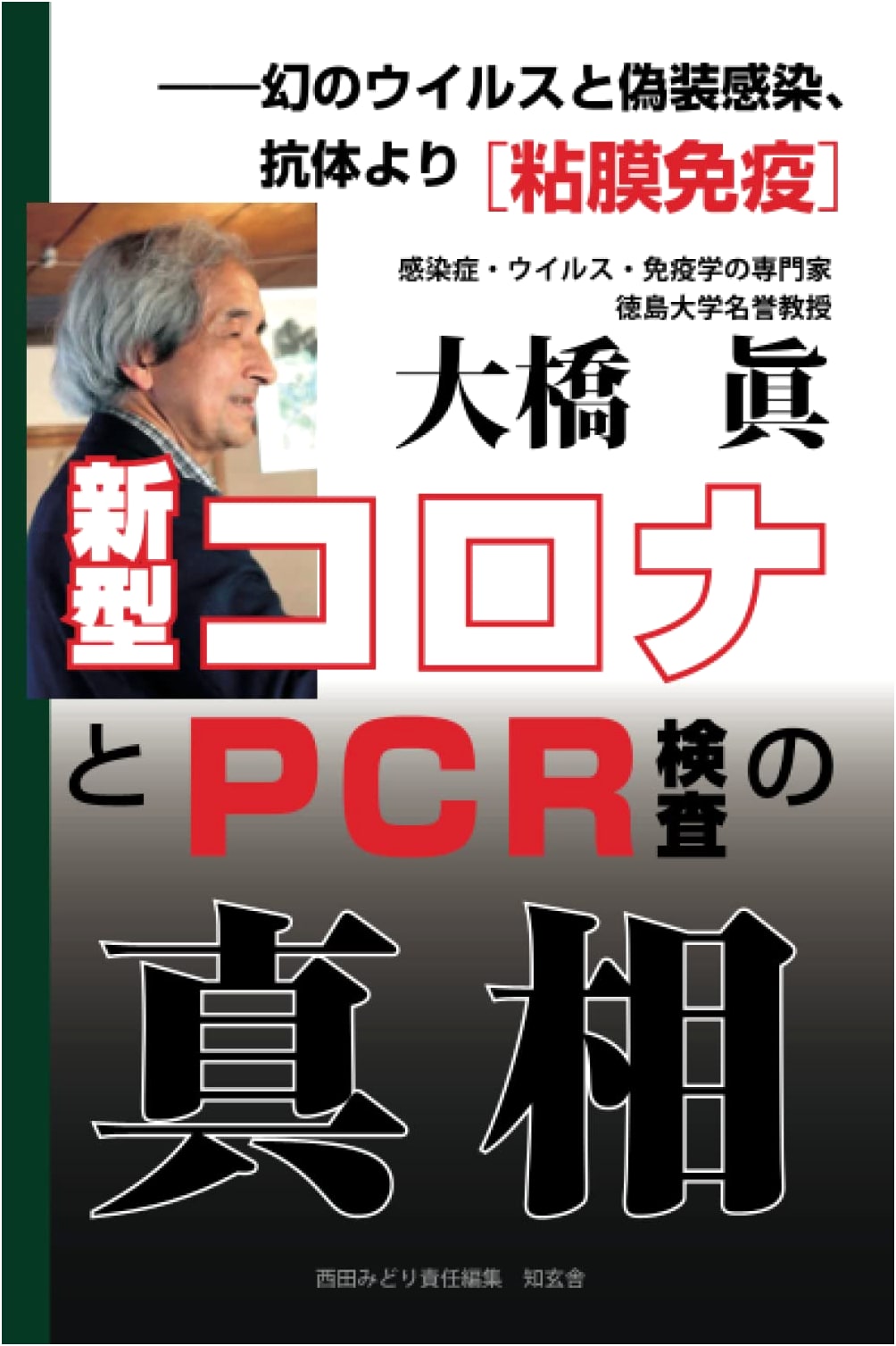 COVID-19 & PCR Test Truth: Phantom Virus, Fake Infection, Mucosal Immunity vs. Antibodies