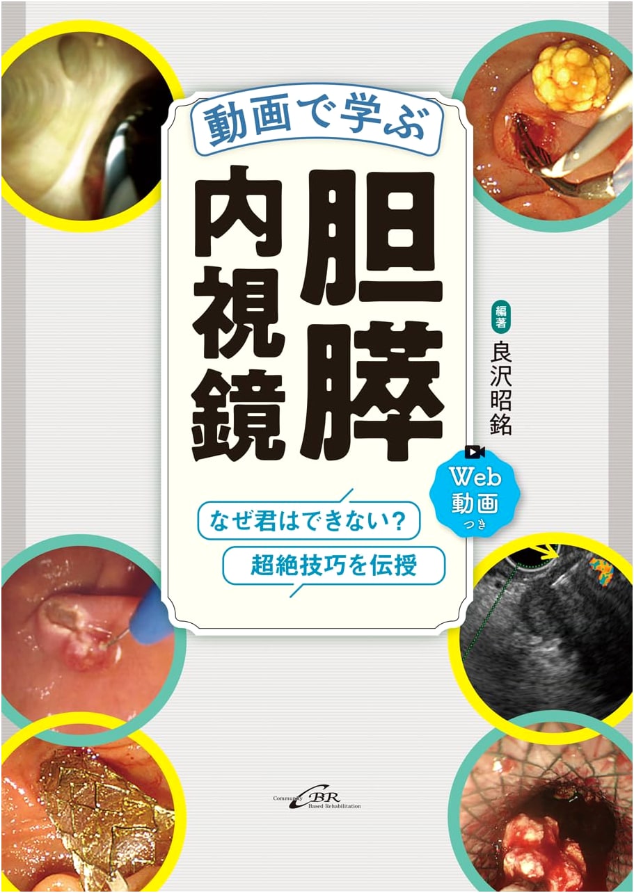 Biliary-Pancreatic Endoscopy: A Video Learning Guide