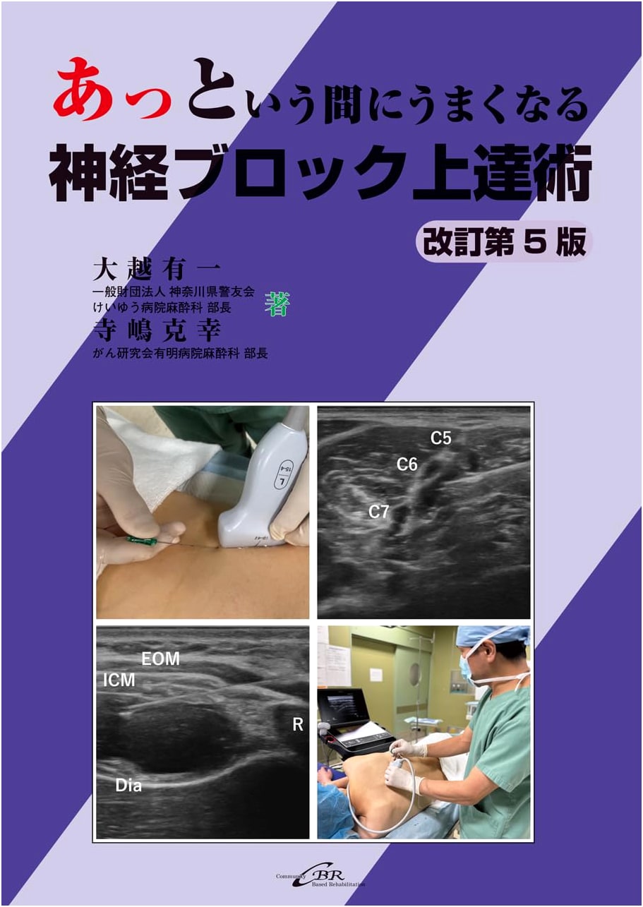 Rapid Mastery of Nerve Block Techniques: Revised 5th Edition